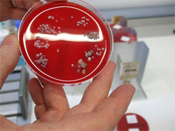 A petri dish containing a red gel on which cultures are growing