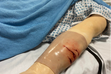 picture showing a manikin wearing a realisitic sim sleeve to show road rash on the forearm